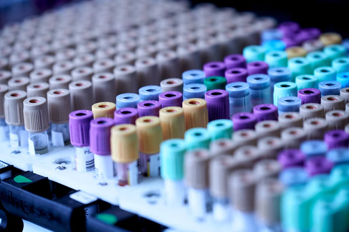 Lab vials used for sample analysis
